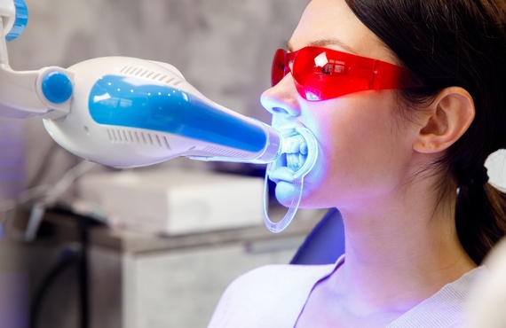 セルフで口内ケア | 鹿児島のホワイトニングならnature miryu