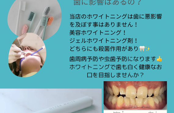 歯へのダメージは？