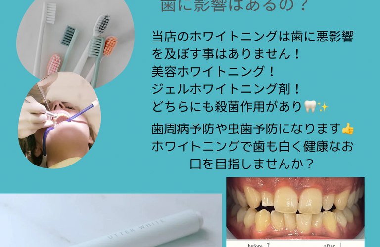 歯へのダメージは？